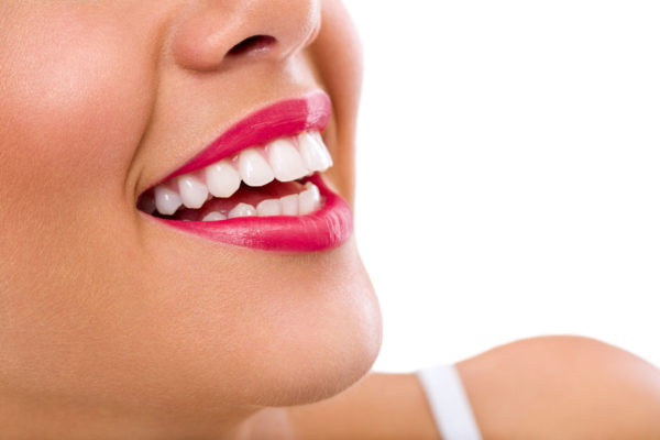 veneers to hide imperfections