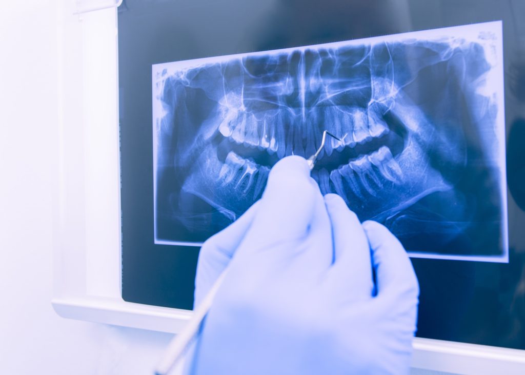 dental xrays