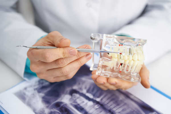 dental implant surgery