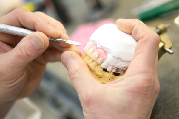 dental implant, implant dentistry